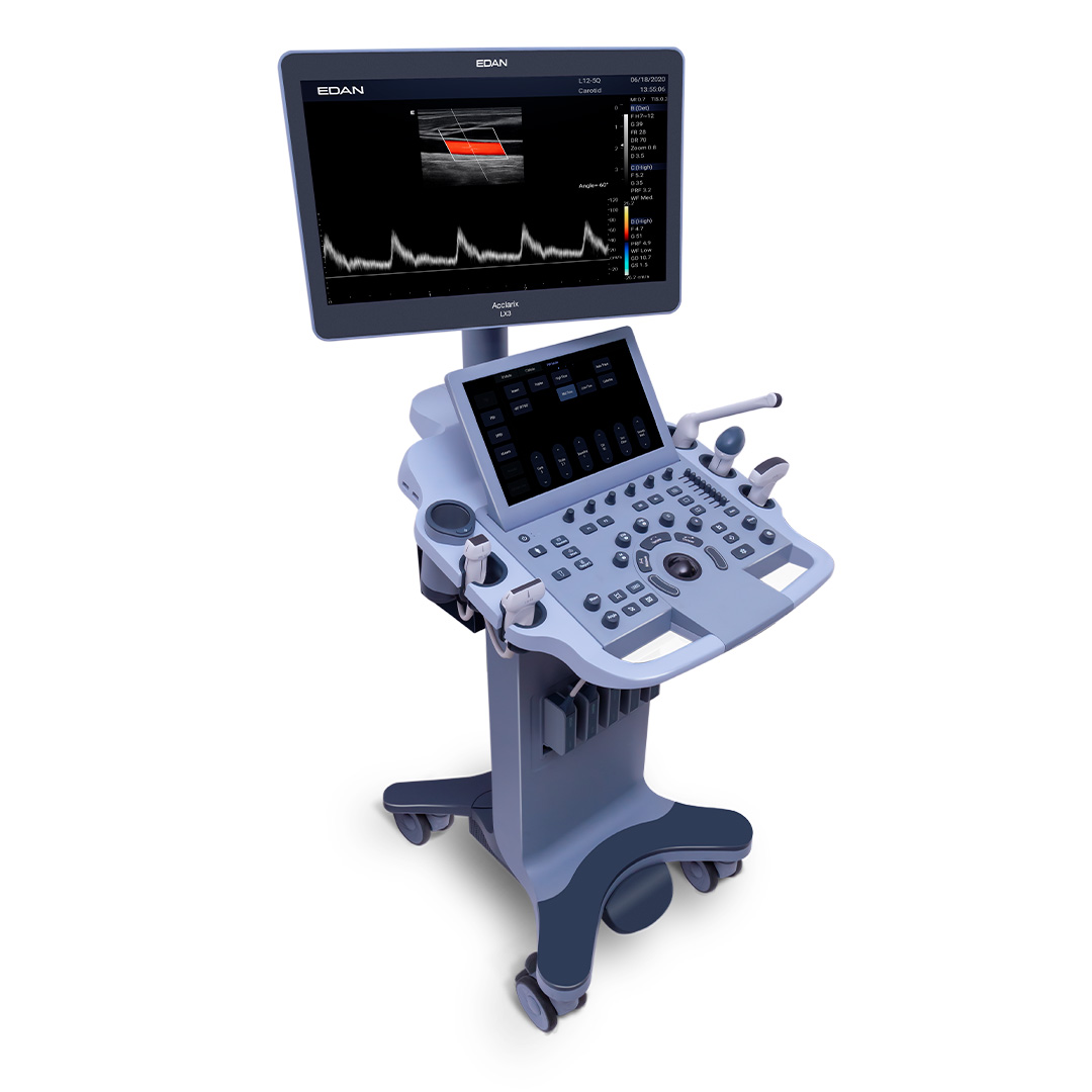 УЗИ аппарат Acclarix LX3